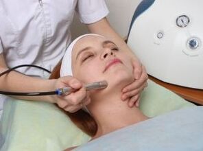 The laser of the face rejuvenates vitality