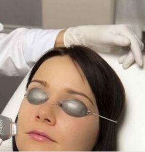 On-site laser recovery