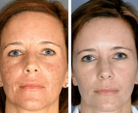 The effect of the program