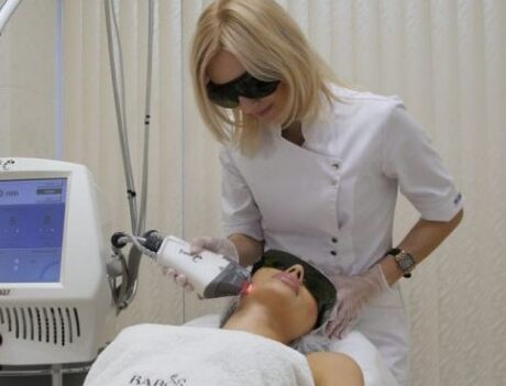 Laser is widely used