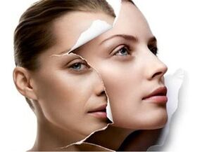 Rejuvenation of skin
