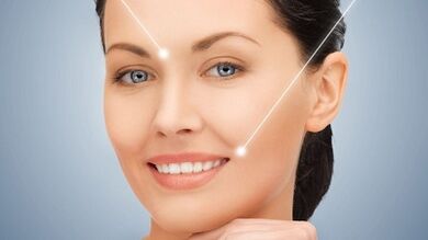 Results after fractional laser skin rejuvenation