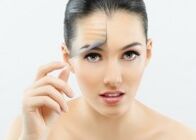 Girl after fractional laser facial rejuvenation surgery