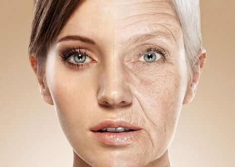 Before and after laser facial rejuvenation