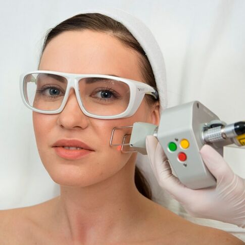 Fractional laser skin rejuvenation surgery can eliminate fine lines