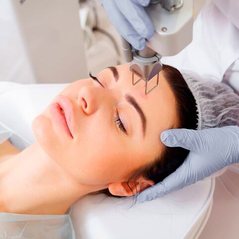Photothermal therapy for facial skin rejuvenation